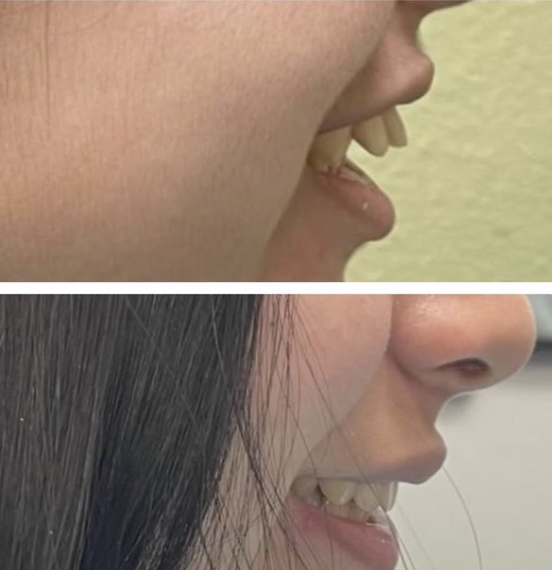 Cosmetic Dentistry Smiles 2