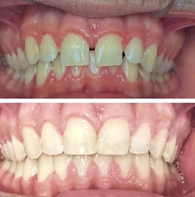 Cosmetic Dentistry Smiles 3