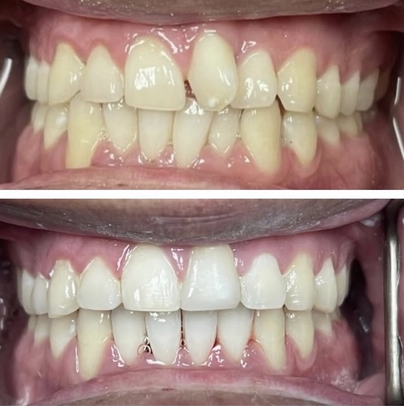 Cosmetic Dentistry Smiles 4