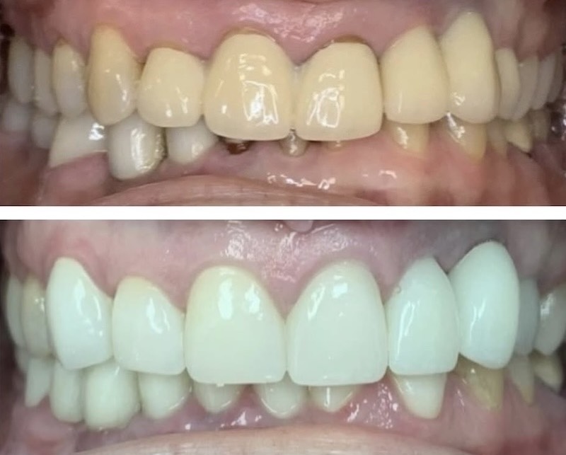 Cosmetic Dentistry Smiles 1