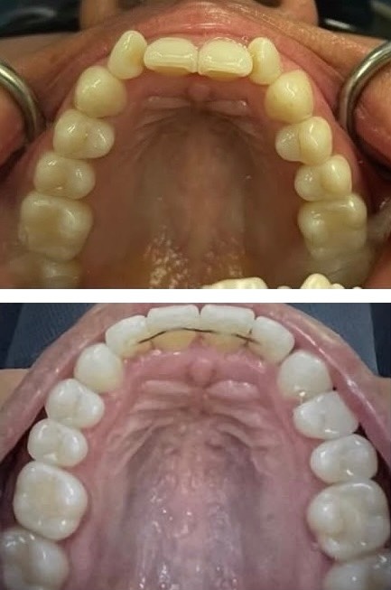 Orthodontics Smiles 1