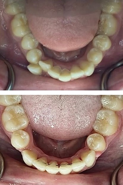 Orthodontics Smiles 2