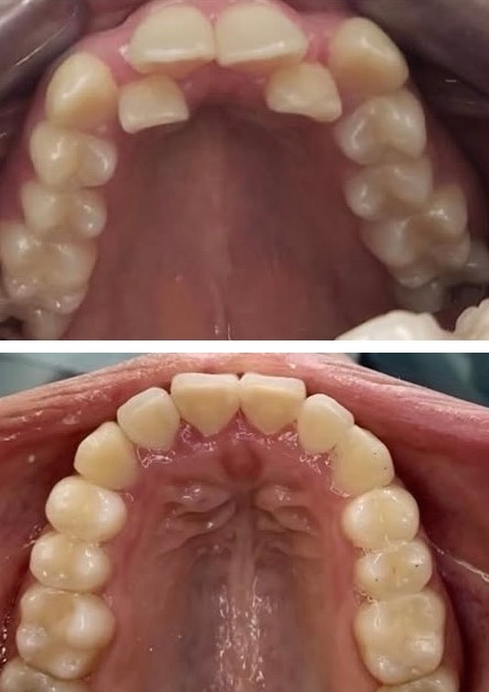 Orthodontics Smiles 3