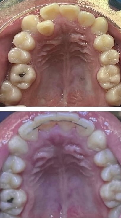 Orthodontics Smiles 4