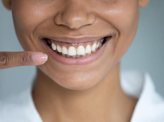 Gum Disease
